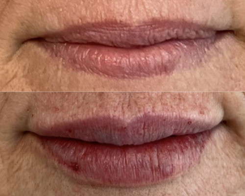 A Close Up Of A Mans Face With An Open Mouth